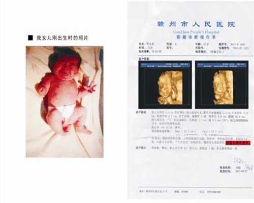 广州专业供卵试管零首付-广州做试管代孕要打多少针