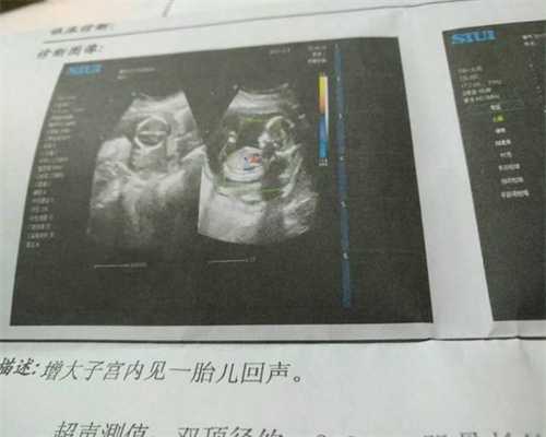 广州供卵试管是合法的_广州试管代孕预约网_【不孕不育我来帮，临床应用保健