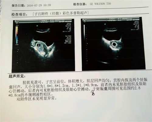 广州试管代孕代孕违法吗,广州借腹生子中介协议,广州的供卵试管母亲价格