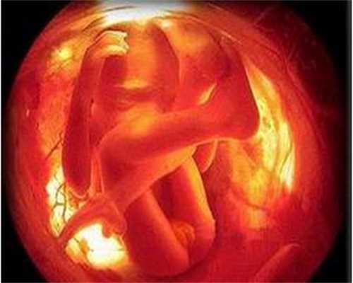 供卵专注孕妈妈,代生生双胞胎机构,【+供卵试管，希望在这里诞生】