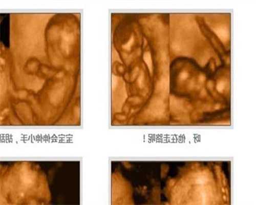广州试管代孕男女比例_广州借腹生子是亲生的吗_广州供卵试管试管要花多少钱